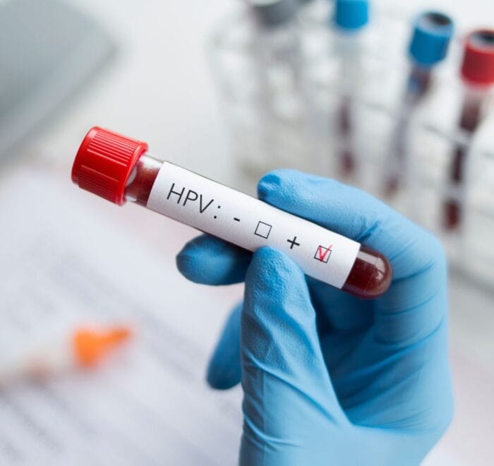 HPV Test