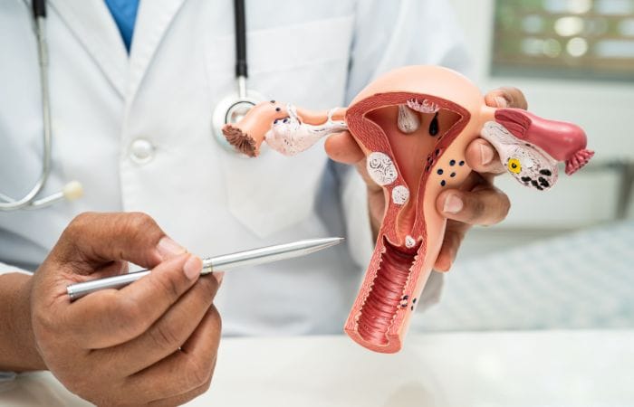 Adenomyosis - Menstrual Health