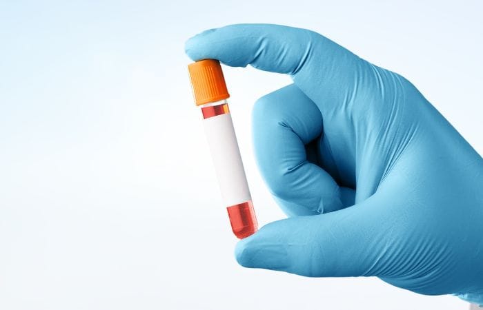 Blood Test – Pre-conception Screening Blood Test - Pre-conception Screening
