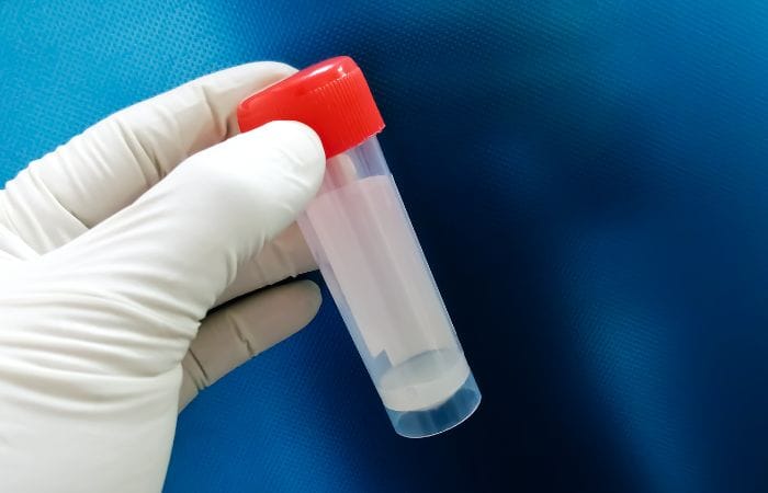 Male Reprodutive Health - Low Sperm