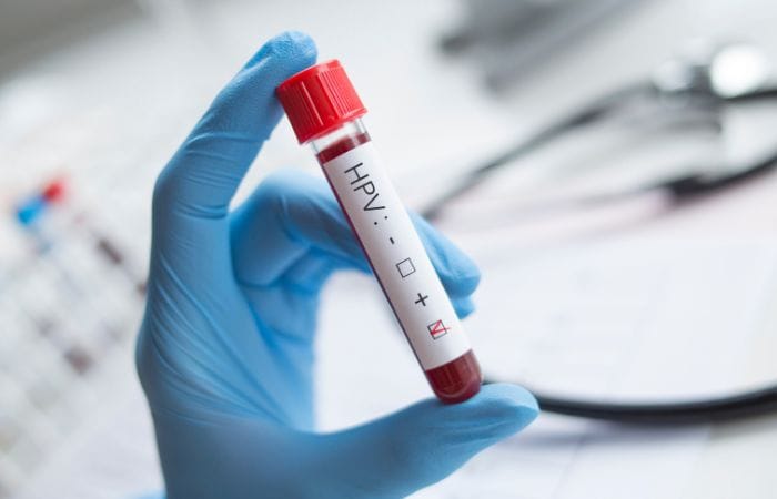 Male Reproductive Health - STI