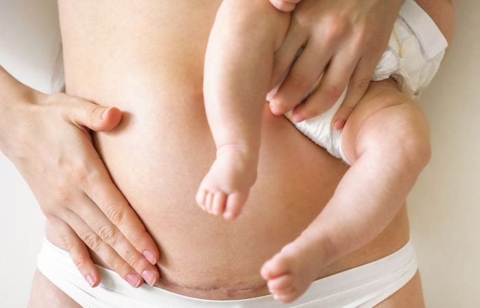 antenatal care and delivery - c section