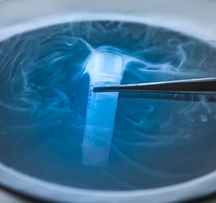 Elective Egg Freezing Package